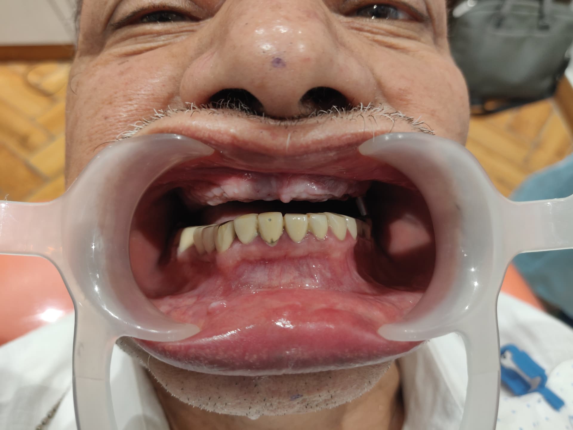 Patient smile before treatment at Ritual Dentistry