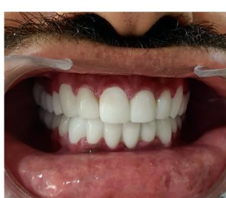 Patient smile after treatment at Ritual Dentistry