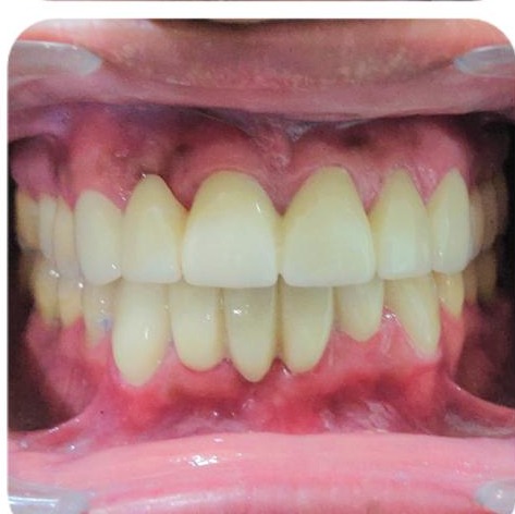 Patient smile after treatment at Ritual Dentistry