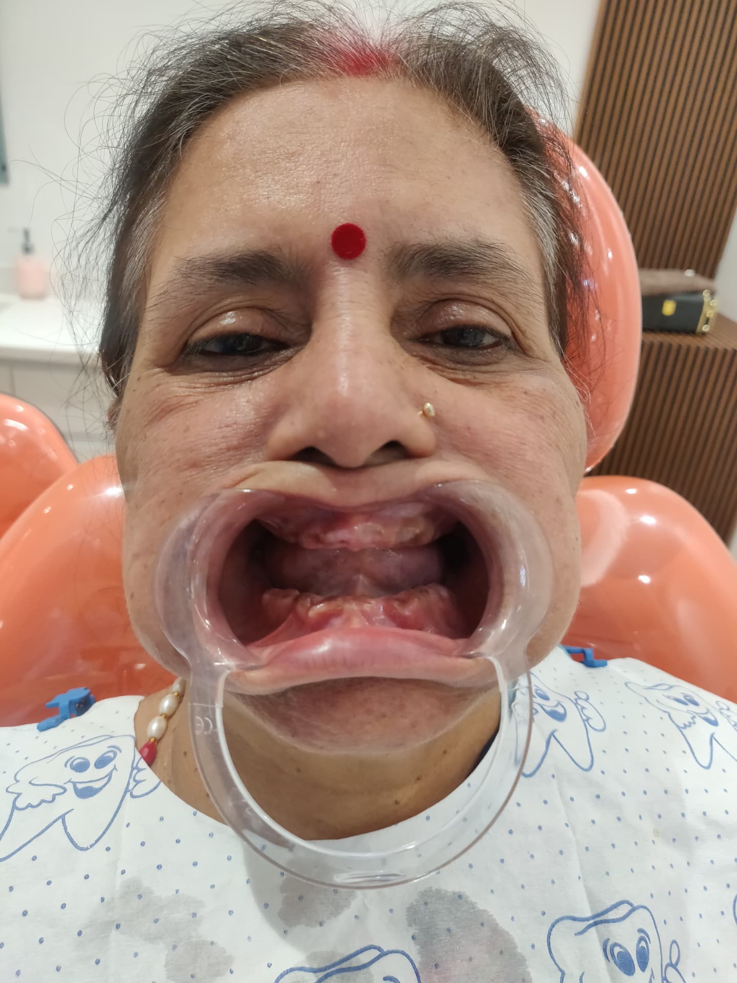 Patient smile before treatment at Ritual Dentistry