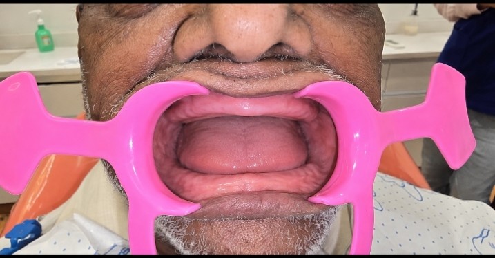 Patient smile before treatment at Ritual Dentistry